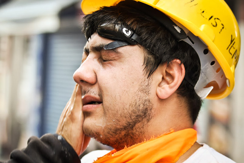 A protester receives first aid after coming into contact with teargas. (Photo by Christan Leonard)