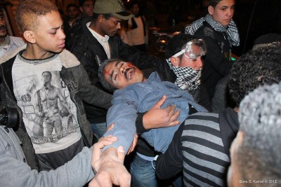 A protestor shot in the face in February 2012 during the period of military rule before Morsi was elected, just one of hundreds killed by police and security forces during that time. (Photo by <a href="http://www.flickr.com/photos/bora25">Bora S. Kamel </a>via Flickr)