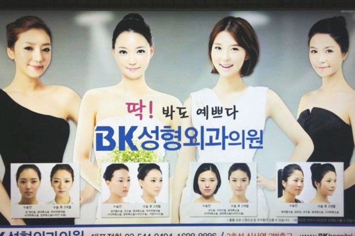A billboard in the posh Gangam district of Seoul, South Korea, advertises eyelid surgery. (Photo by Jason Park)