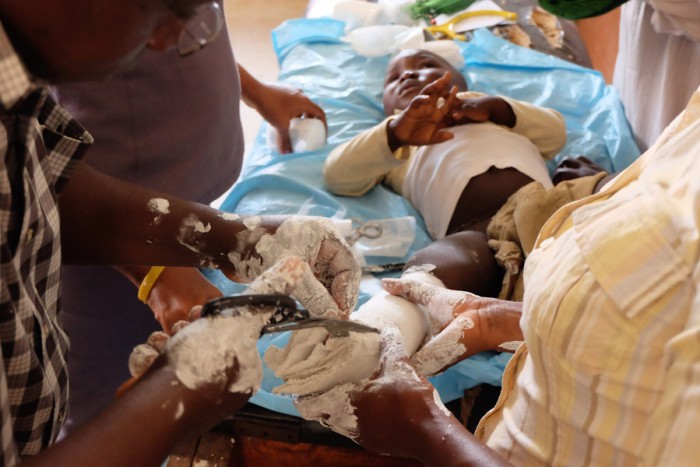 Mohamed Bangura is treated for clubfoot using the Ponseti Method, a non-surgical technique using a series of casts and braces. (Photo by Debra Bell)
